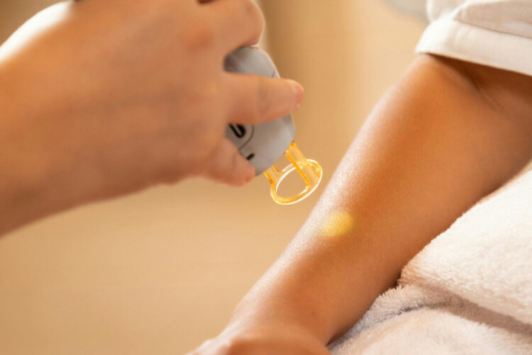 ¿Qué tipo de depilación le conviene a tu piel?